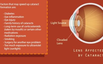 Cataract Awareness Infographic F