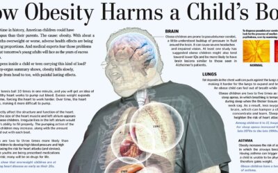 Obesity Trend in Kids Is Actually a Result of Unhealthy Habits
