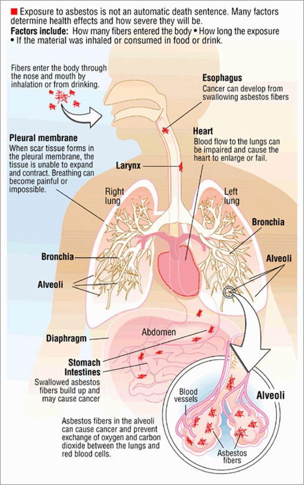 Mesothelioma and Asbestos Exposure Infographic