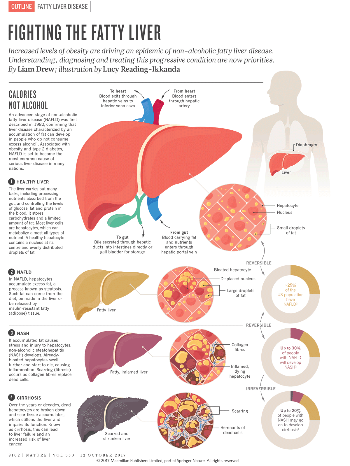 Nonalcoholic Fatty Liver Disease