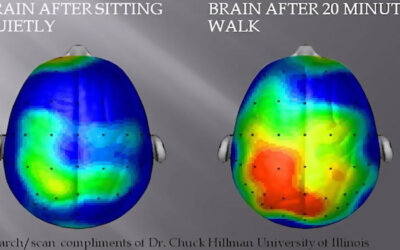 Regular Exercise Could Protect the Brain from Silent Strokes