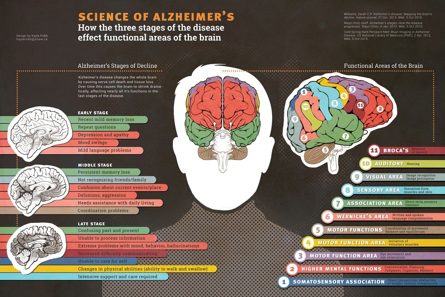 Science of Alzheimers Infographic