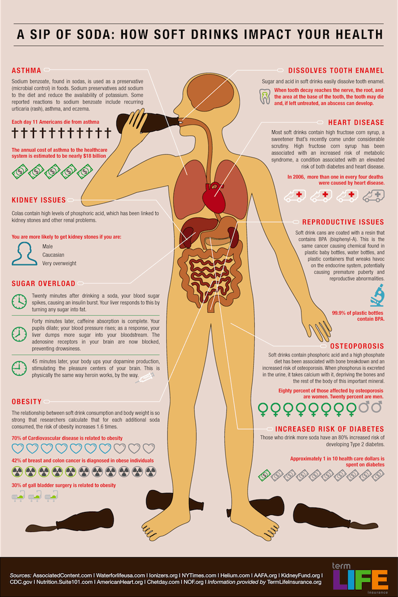 Soda Infographic
