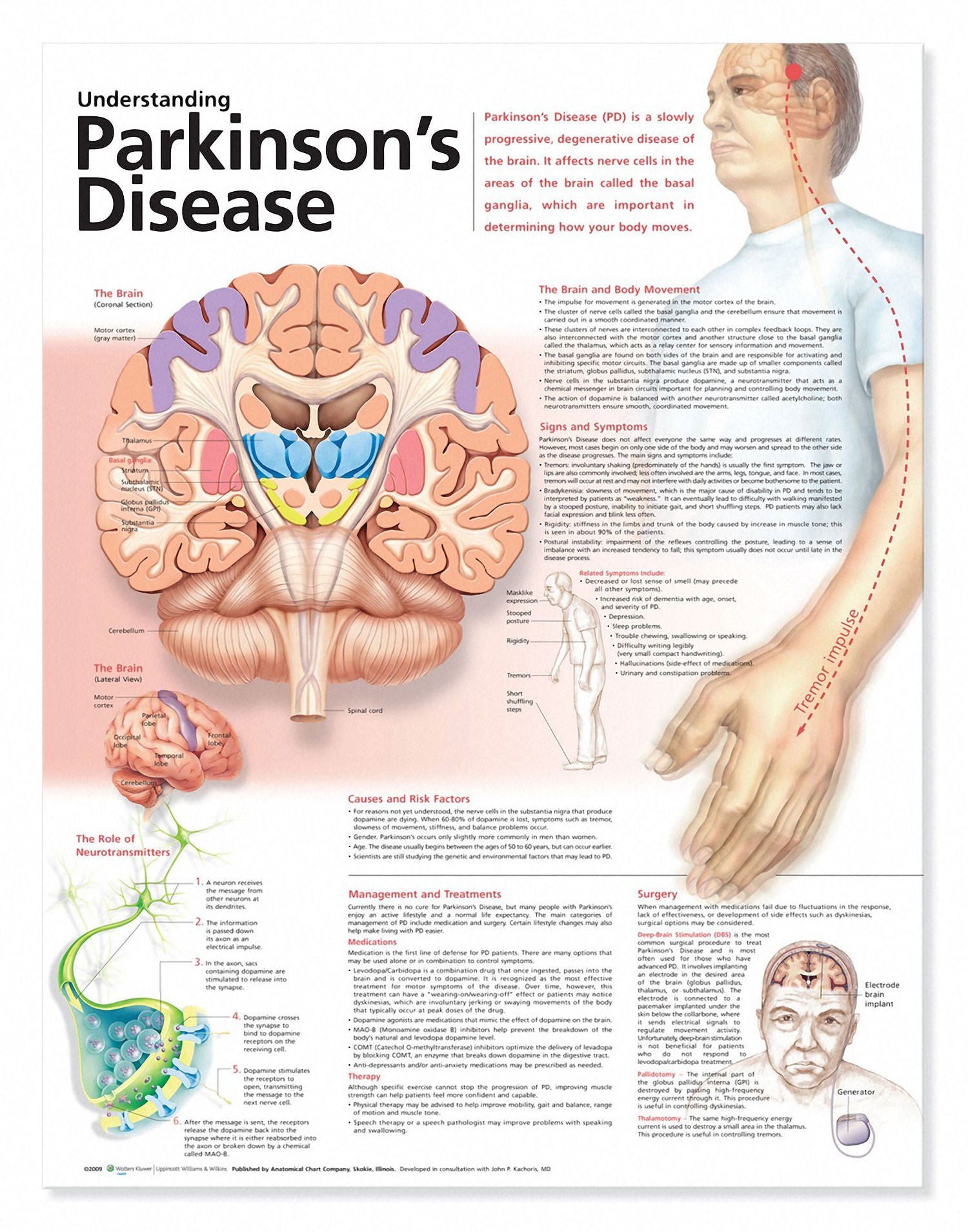 Understanding Parkinsons Disease Chart
