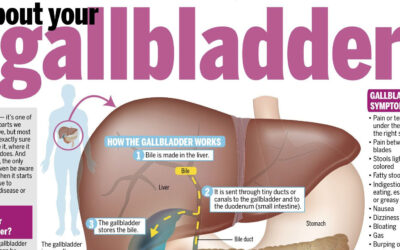 Gallbladder Infographic F